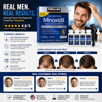 Kirkland 5% Minoxidil with Derma Roller - 6 Month Hair Regrowth Kit Set